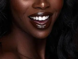 Missxynn