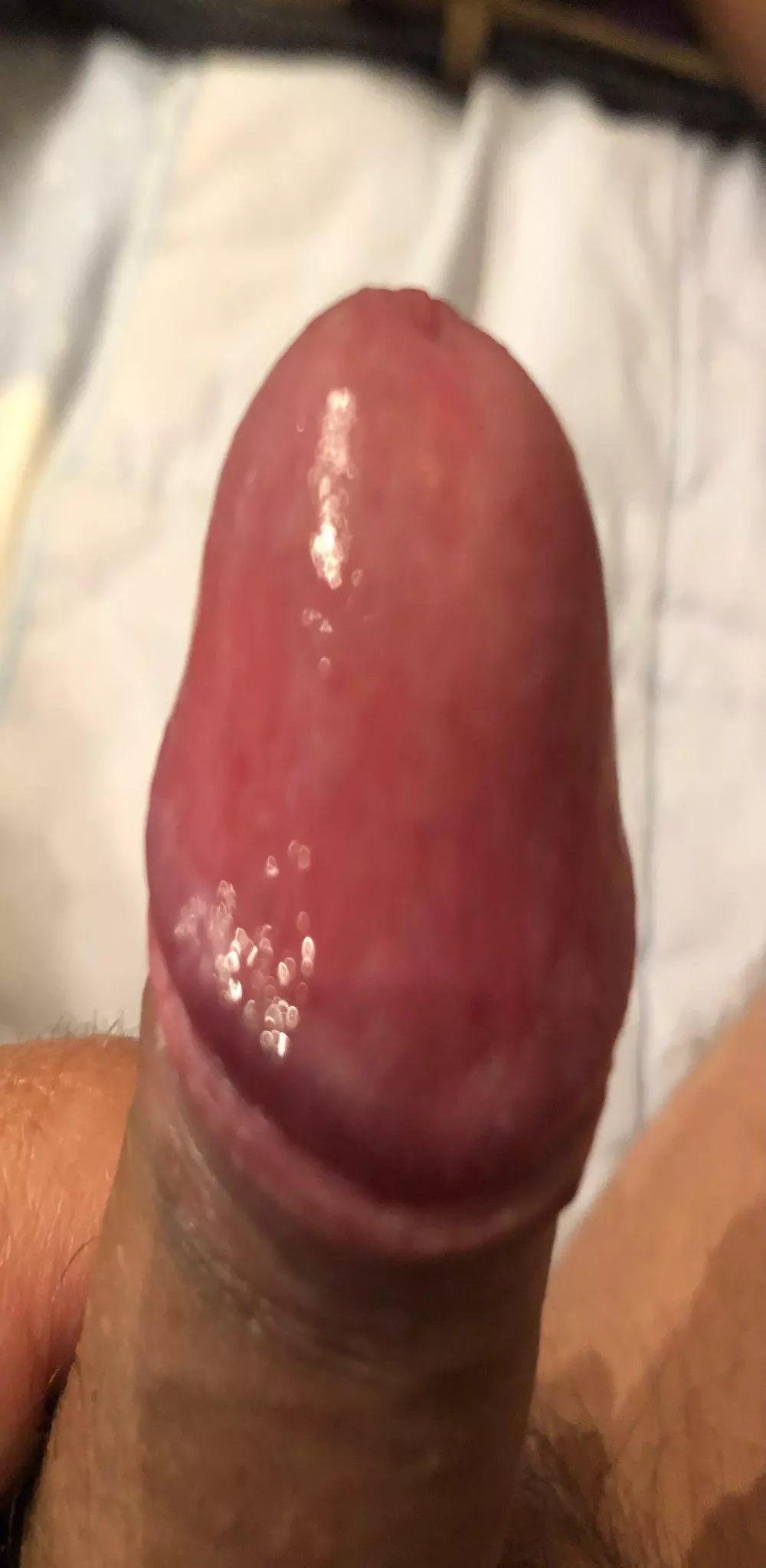 almeidanuno