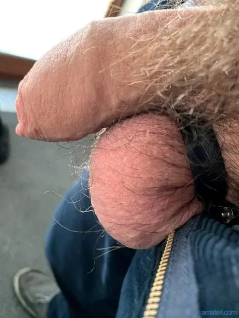69bezfleku